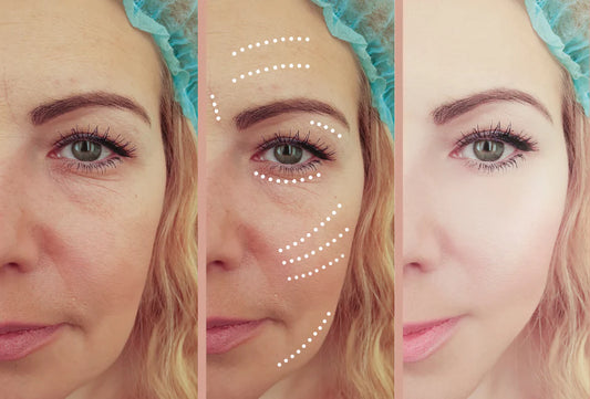 GoldPeelMask-Logo-White Order Buy 1 Get 1 Free