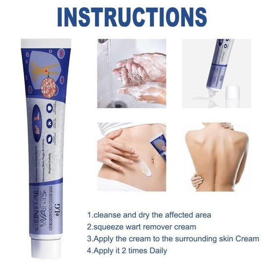 Lucky Glow Genital Warts Remover Cream (20gm)